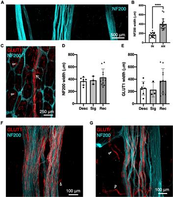 Characterisation of parasympathetic ascending nerves in human colon